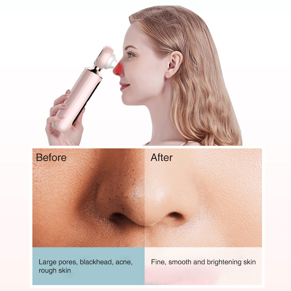 Visual Blackhead Vacuum Remover with Magnifier LED Light Face T Zone Pore Cleaner Acne Black Pimple Electric Blackhead Removal - Trendha